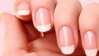 How To Whiten Your Nails Using Denture Cleaner Be Patient [upl. by Xyla284]