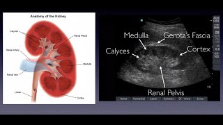 Introduction to Renal Ultrasound [upl. by Chader119]