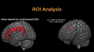 fMRI Short Course 9 ROI Analysis [upl. by Agatha634]