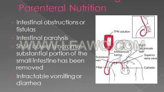 Chapter 15 Enteral and Parenteral Nutrition [upl. by Ellerrehs121]