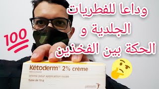 كيفية علاج الفطريات الجلدية بين الفخدين و المناطق الحساسة بكريم كيتودرم ketoderm [upl. by Angell]