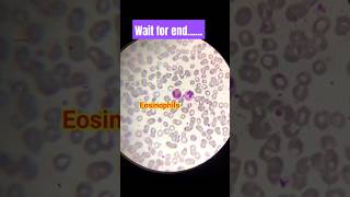 Microscopic examination of blood smear  shorts trendingshorts viral dmlt bloodtest lab [upl. by Drofdarb975]