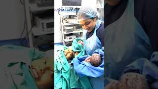 Cesarean Delivery  Twin Babies Born CSection Surgery cesareansection cesareanbirth ytshorts [upl. by Darnell]