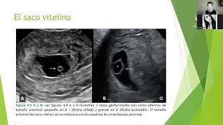 Clase 1 Ecografía Obstétrica de 1er trimestre [upl. by Housen]