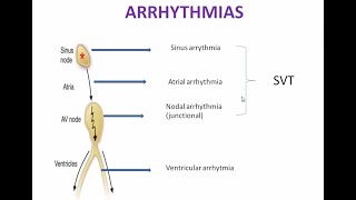 Treatment of Arrhythmia Pharmacology  Antiarrhythmic Drugs Pharmacology Mnemonics  Part 1 [upl. by Airelav]