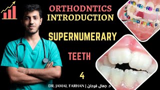 ORTHODONTIC  Lecture 2  Part 4  Supernumerary teeth  كورس تقويم الاسنان [upl. by Edlun442]