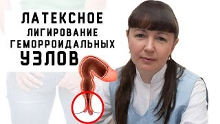 Методы лечения хронического геморроя Латексное лигирование геморроидальных узлов [upl. by Zischke442]