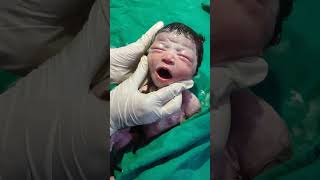 Essential care of new born baby after birth viralvideo littleprince mylittleprince mylittle [upl. by Beulah520]