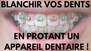 Comment Blanchir Vos Dents en Portant Un Appareil Dentaire [upl. by Savitt]