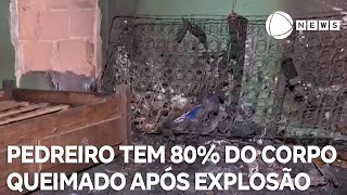 Pedreiro tem 80 do corpo queimado após botijão explodir [upl. by Nerot]