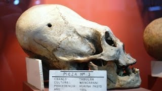 Secret Filming Of Odd Elongated Human Skulls In Bolivia [upl. by Milena]