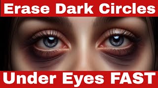 How to Eliminate Under Eye Circles  7 Proven Tips to Get Rid of Dark Circles Under Eyes at Home [upl. by Fredra]