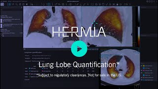 Hermia Lung Lobe Quantitation [upl. by Belayneh]