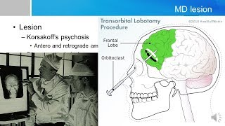 Neurosurgery written board crash course  thalamus part 12 [upl. by Orihakat876]