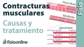 Contractura muscular  Qué es cómo sucede y cuál es su tratamiento [upl. by Aleciram411]