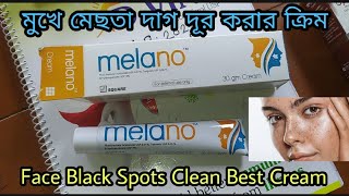 Melano Cream এর কাজ কি দাম কত ব্যবহার করার নিয়মবিস্তিরিত ভিডিও তে । [upl. by Bevon]