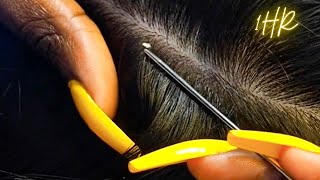 ASMR 1 HR Super Attentive NITPICKING SCALP WHITEHEADS  zoomed [upl. by Wehttan]