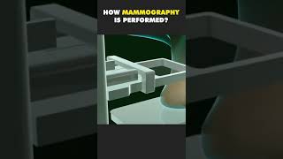 HOW MAMMOGRAPHY IS PERFORMED  3D ANIMATION [upl. by Nnaael]