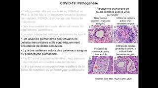 COVID19 symptômes pathogenèse [upl. by Konstantin410]