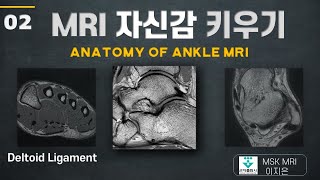 MRI 자신감키우기02 Deltoid ligament Ankle MRI anatomy tibiotalar ligament 군자출판사 [upl. by Richarda]