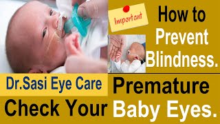 Prevent Blindness  Premature Babies  Check your Baby Eyes Immediately  DrSasi [upl. by Tonye]