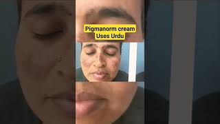 Pigmanorm cream Uses in urduHindi  Pigmanorm whitening cream  pigmanorm cream  Dr Nadeem [upl. by Intisar]