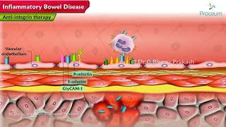 Inflammatory Bowel Disease Pharmacology Lectures [upl. by Lerrad]