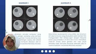 Rekontruksi Tomografi dalam Kedokteran Nuklir [upl. by Fatimah]