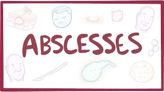 Abscesses  causes symptoms diagnosis treatment pathology [upl. by Freeland222]