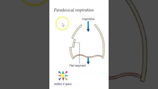 Anatomy Thorax 276 lung Paradoxical Respiration Flail Segment of rib inspiration chest [upl. by Ramak]