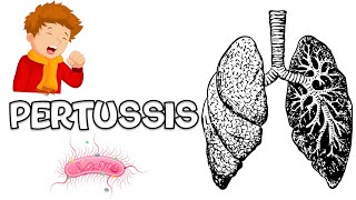 Pertussis Whooping Cough  Causes Signs amp Symptoms Complications Diagnosis And Treatment [upl. by Nyleuqaj]