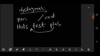 Otolaryngology  ENT  Vestibular neuronitis [upl. by Ahsened]