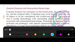 chapter 160 tintinalli emergency medicine head trauma [upl. by Norvol]