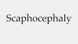 How to Pronounce Scaphocephaly [upl. by Roseann]