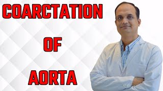 Coarctation of aorta [upl. by Adnylam]