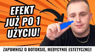 ROSSMANN❗️EFEKT JUŻ PO 1 UZYCIU❗️Zapomnisz o BOTOKSIE MEDYCYNIE ESTETYCZNEJ I MASAŻACH TWARZY❗️ [upl. by Elane]