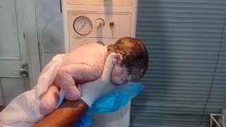 New born baby very very beautiful came with vernix remove vernix baby is so cute💙💙clean with baby💙 [upl. by Noemys479]