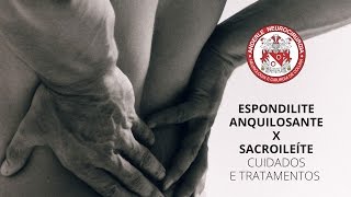 Espondilite Anquilosante x Sacroileíte  CUIDADOS e TRATAMENTOS  Dr Diogo Neurocirurgião [upl. by Bois]