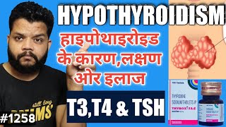 थायरॉइड बढ़ने का कारण ओर इलाज  Hypothyroidism Causes Symptoms amp Treatment In Hindi [upl. by Ojytteb677]