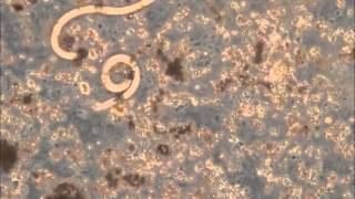 Video clip 1 of Angiostrongylus cantonensis in solution with residual slug tissue [upl. by Forcier990]