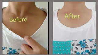 DIY hacks।how to fix stretched neckline।sewing tips httpsyoutubeATBMjbloV3csiO5TEr7dhB87KqP5 [upl. by Torrin]