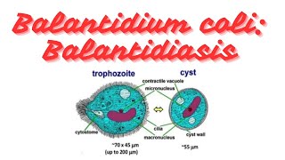 Balantidium coli Balantidiasis Clinical parasitology [upl. by Arathorn]