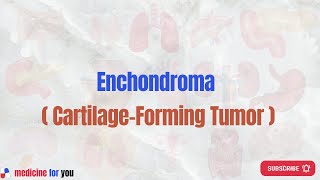 Enchondroma  CartilageForming Tumor [upl. by Sedruol284]