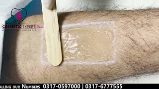 For the First Time in Islamabad and Peshawar Laser Hair Removal Treatment [upl. by Emmye]