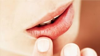 The Basics Canker Sore Causes and Treatments [upl. by Acisej]