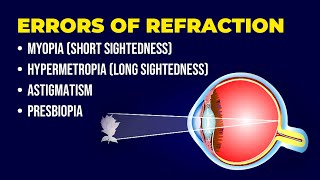 Errors of Refraction  Myopia  Hypermetropia  Astigmatism  Presbiopia  Short amp Long Sightedness [upl. by Ahsram]