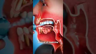 How An Inhaler Works 🤔viral shorts ‎drMaryamGull [upl. by Sirovart182]