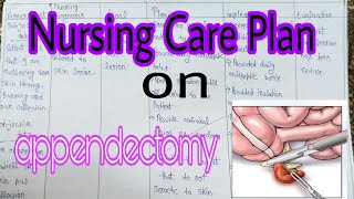 NCP  Nursing Care Plan on appendectomy  appendectomy  NCP on appendectomy by RAJEEV GUPTA [upl. by Burgener]