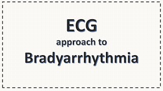 ECG Approach to Bradyarrhythmia  Bradycardia  Simplified [upl. by Lydell]