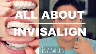 INVISALIGN REVIEW  HOW IT WORKS AND WHAT TO EXPECT [upl. by Shaff975]